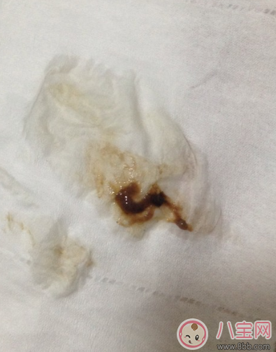 懷孕褐色分泌物是男孩 懷孕初期有褐色分泌物流出是男孩嗎