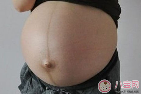 怎么通過妊娠紋判斷懷的是男是女    妊娠紋判斷性別方法