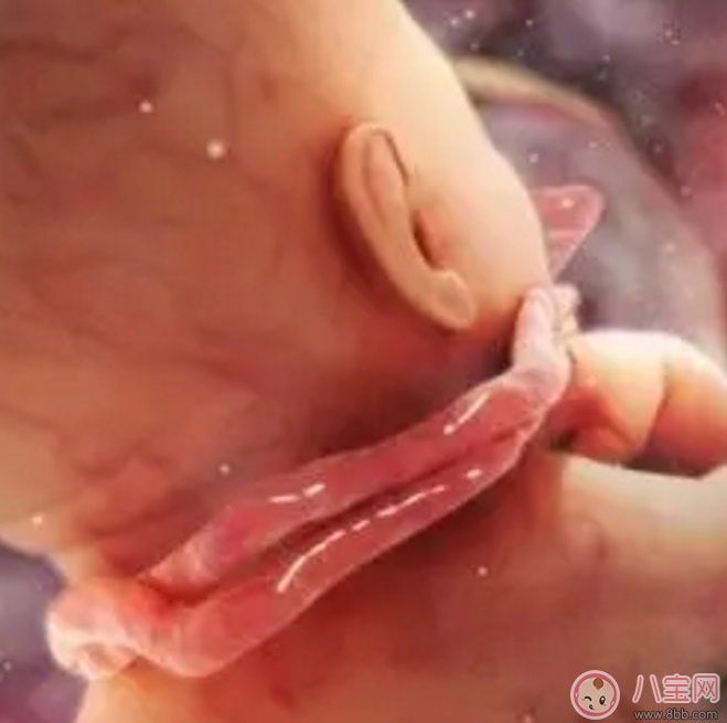 胎兒臍帶繞頸怎么辦？產(chǎn)前怎樣化解臍帶繞頸？