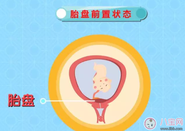 懷孕后那些情況不能順產(chǎn) 有些時候多聽醫(yī)囑準(zhǔn)沒錯