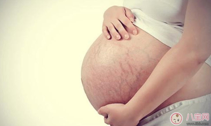 孕婦妊娠紋怎么預(yù)防 孕婦預(yù)防妊娠紋吃什么