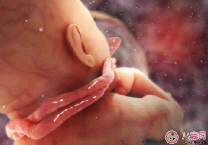 臍帶繞頸怎么辦 嬰兒臍帶繞頸嚴(yán)重嗎