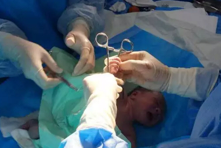 剪臍帶時(shí)寶寶會(huì)不會(huì)疼 剪臍帶是寶寶疼還是媽媽疼