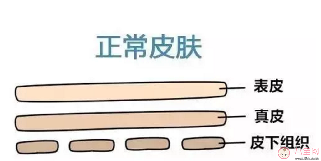 擺脫妊娠紋  哪些方法容易又簡(jiǎn)單