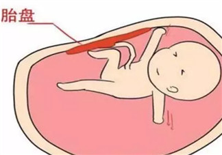 胎盤三級就已經(jīng)老化了嗎 胎盤老化判斷標準