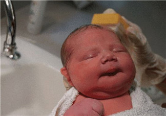 順產頭擠變形多久恢復 如何預防寶寶順產頭變形