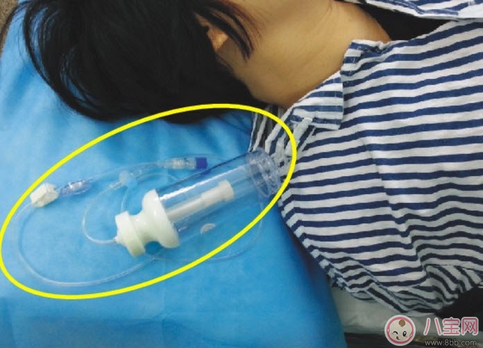 剖腹產(chǎn)的過(guò)程是怎么樣的 剖腹產(chǎn)手術(shù)前手術(shù)中手術(shù)后流程揭秘