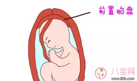 什么是孕晚期見(jiàn)紅 孕晚期見(jiàn)紅肚子疼怎么辦