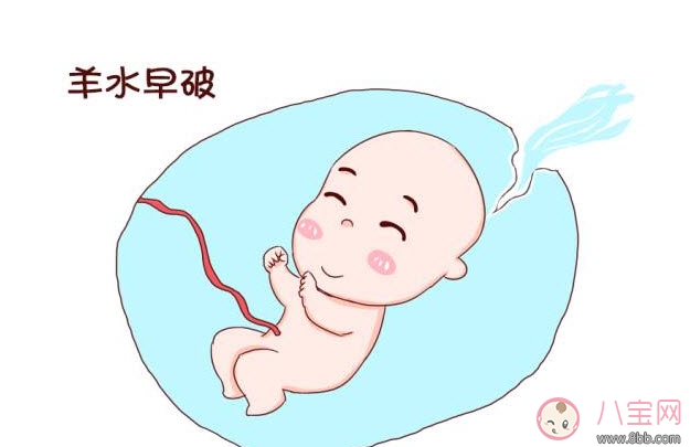 孕中期羊水早破的癥狀 如何預(yù)防羊水早破