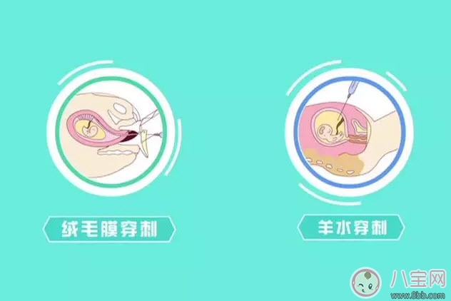 從懷孕到生要做幾次b超 懷孕做多少次b超合適(孕期b超時(shí)間表)