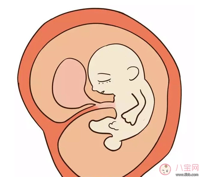 孕晚期羊水過多怎么辦 羊水過多的原因