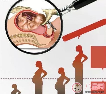 剖腹產(chǎn)孕婦會(huì)不會(huì)感到疼痛 剖腹產(chǎn)橫剖還是縱剖。