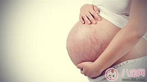 妊娠紋什么時候長    怎么預(yù)防妊娠紋