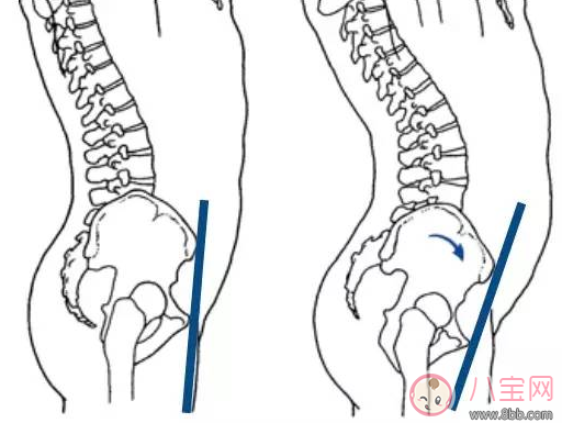 柯基臀是骨盆前傾嗎 李菲兒的柯基臀是怎么練成的