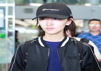 周冬雨下巴為什么會(huì)出現(xiàn)疤痕 周冬雨下巴受傷的原因