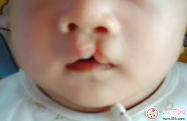 孕婦能吃兔肉嗎 孕婦吃兔肉對(duì)寶寶有什么好處