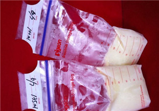母乳儲(chǔ)存袋哪個(gè)牌子好 貝親母乳保存袋怎么樣