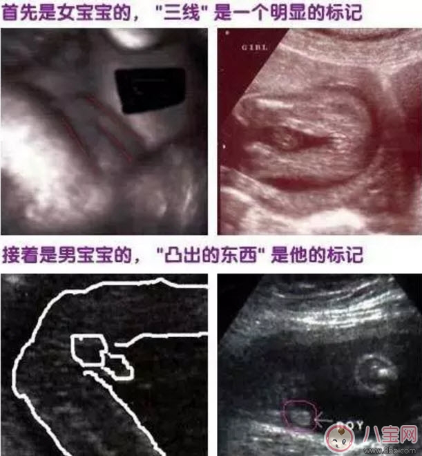 二胎生男生女早知道 第二胎生男生女早知道小妙招