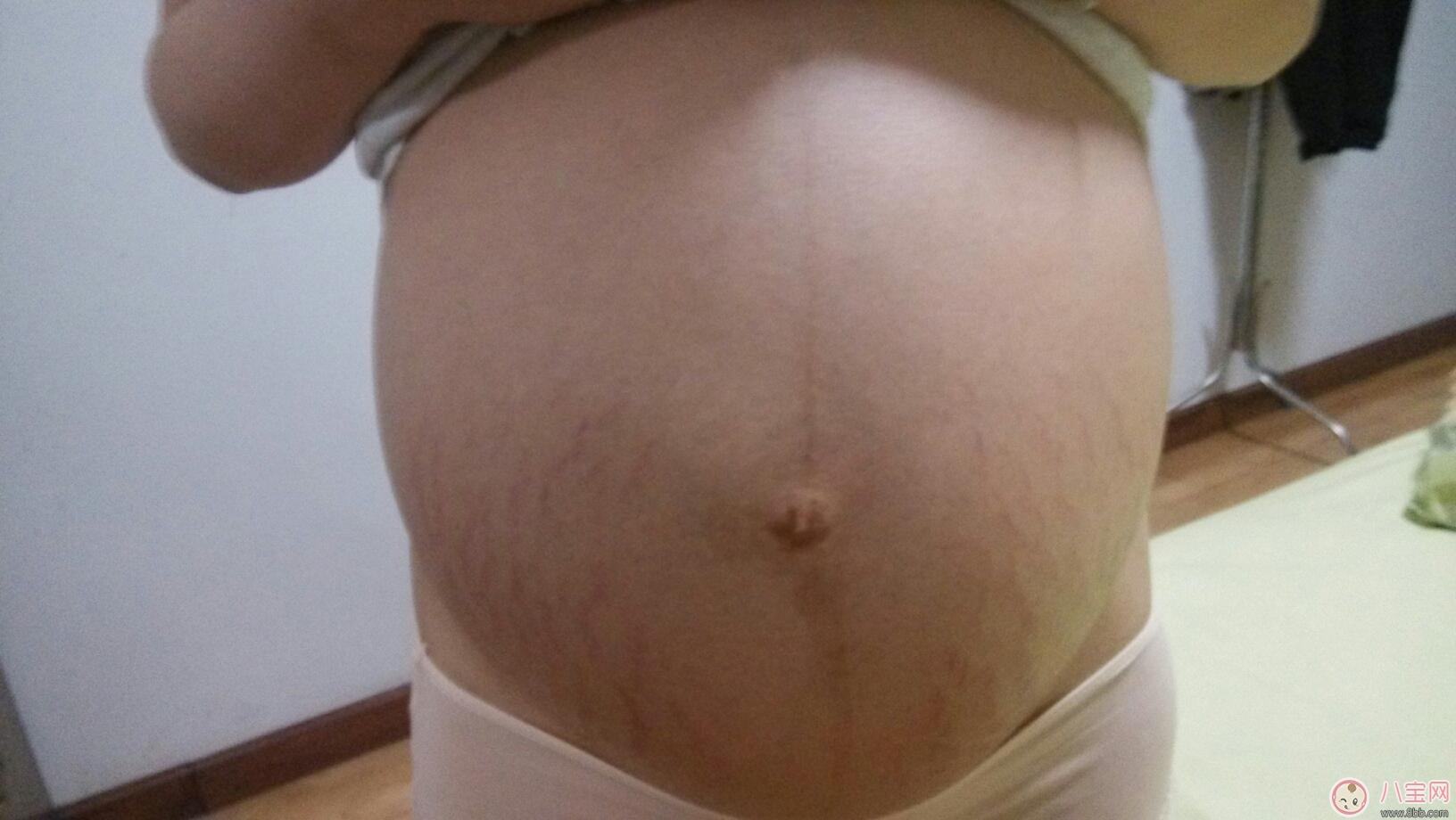 孕辰紋怎么消除 這些產(chǎn)品防止孕辰紋產(chǎn)生和消除孕辰紋