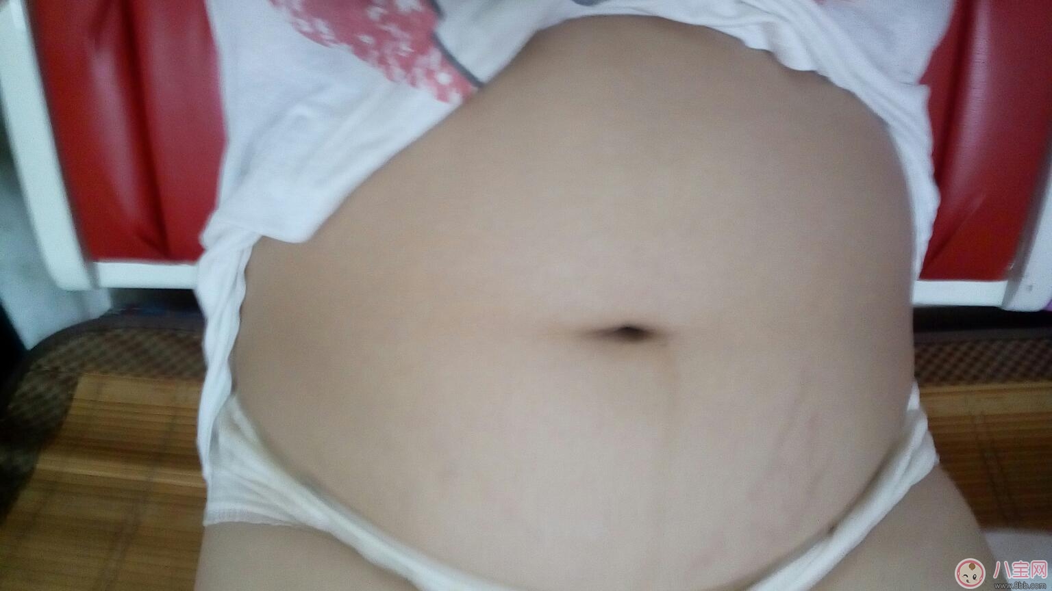 孕辰紋怎么消除 這些產(chǎn)品防止孕辰紋產(chǎn)生和消除孕辰紋