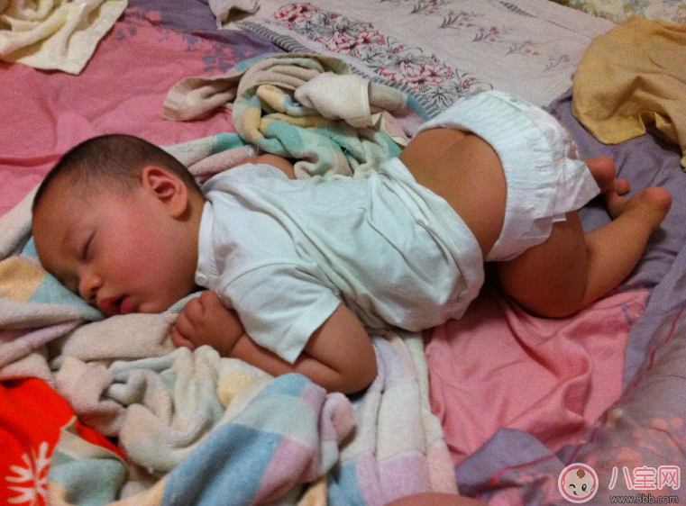 寶寶痱子總不消 用用這個準會好