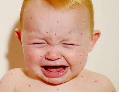 風(fēng)油精寶寶能用嗎    寶寶使用風(fēng)油精的危害