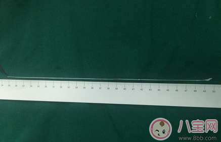 喝生水長寄生蟲是真的嗎 喝生水會(huì)有寄生蟲嗎