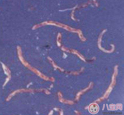 喝生水長寄生蟲是真的嗎 喝生水會(huì)有寄生蟲嗎