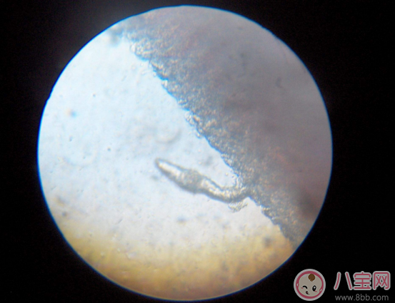 喝生水長寄生蟲是真的嗎 喝生水會(huì)有寄生蟲嗎