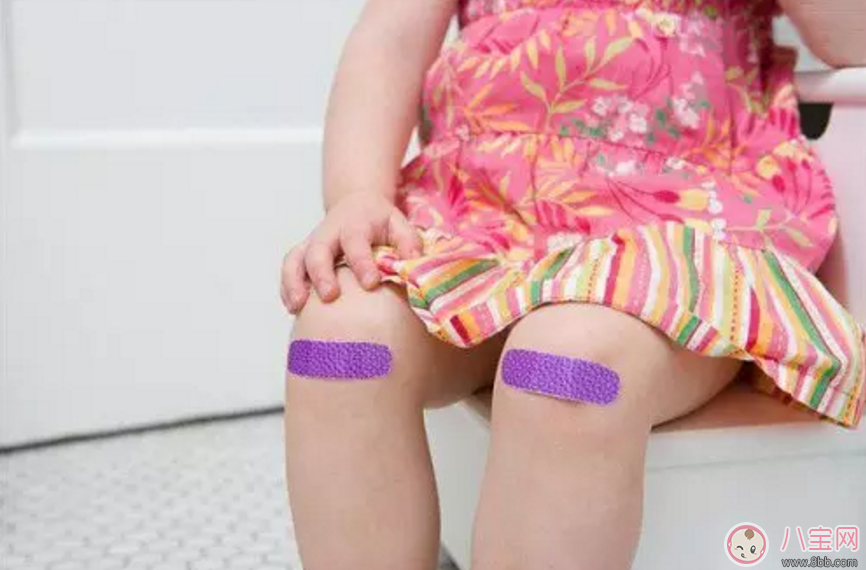 寶寶意外受傷怎么辦 如何避免破傷風(fēng)