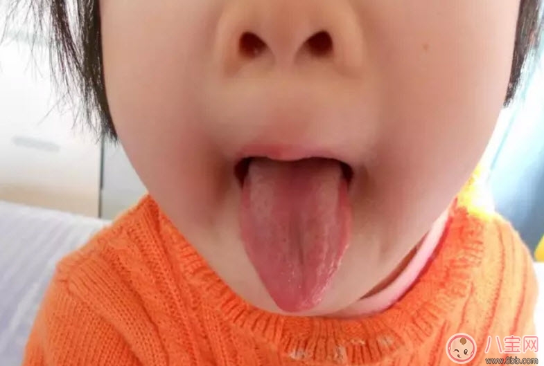 寶寶積食發(fā)燒和感冒發(fā)燒的區(qū)別癥狀 寶寶積食發(fā)燒怎么解決