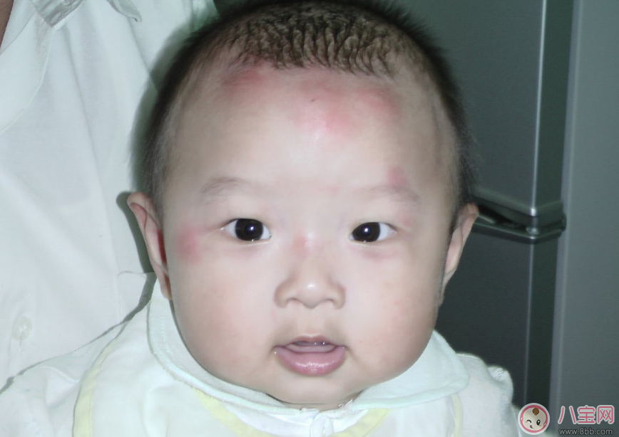 孩子皮膚變差怎么辦 秋季孩子護(hù)膚方法