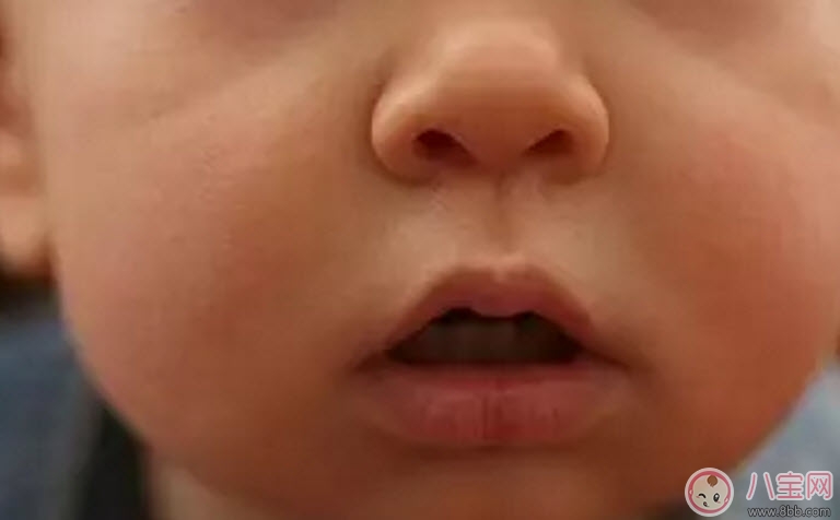 秋天怎么預(yù)防寶寶口角炎 寶寶口角炎的食療方法
