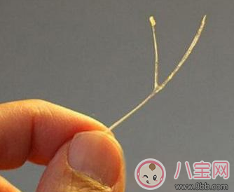 寶寶吃魚卡魚刺 急著自己去夾刺就大錯(cuò)特錯(cuò)了