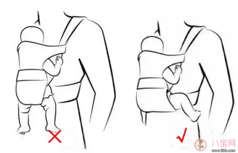 嬰兒為什么是青蛙腿 寶寶青蛙腿用不用綁腿