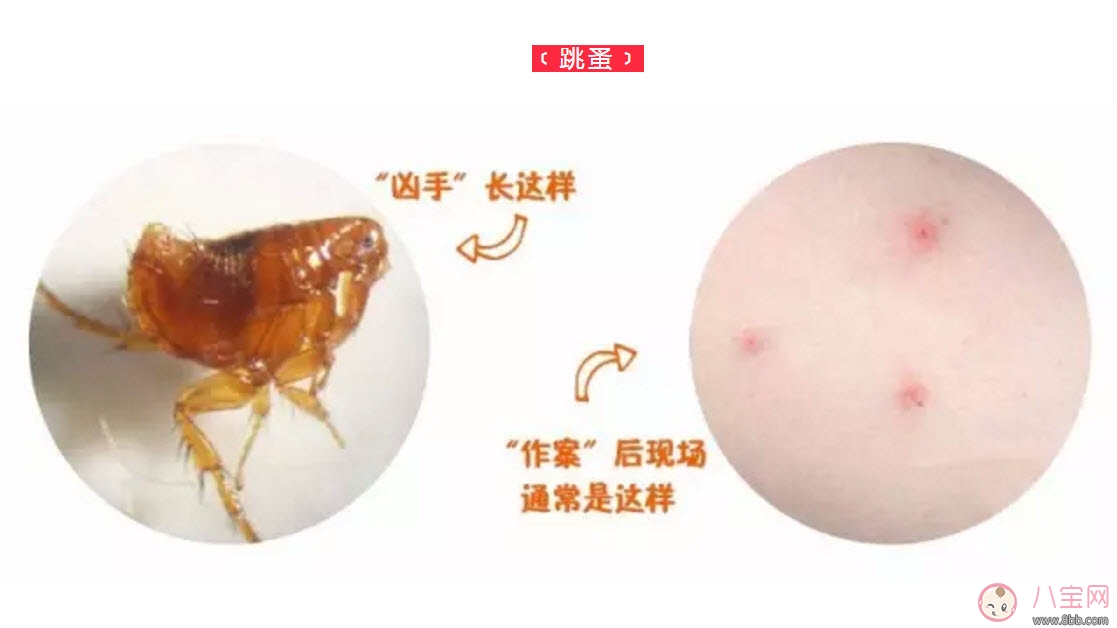 寶寶被跳蚤咬了癥狀圖片 寶寶被跳蚤咬和蚊子咬癥狀對比圖片區(qū)別