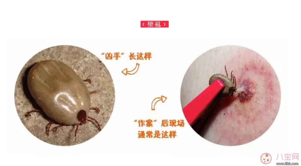 寶寶被蜱蟲咬了癥狀圖片 寶寶被蜱蟲咬和蚊子咬癥狀對(duì)比圖片區(qū)別