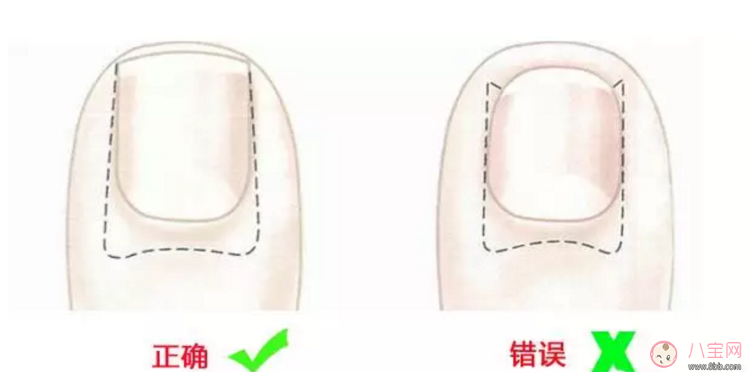 給寶寶剪指甲如何避免錯(cuò)誤 如何正確的給寶寶剪指甲