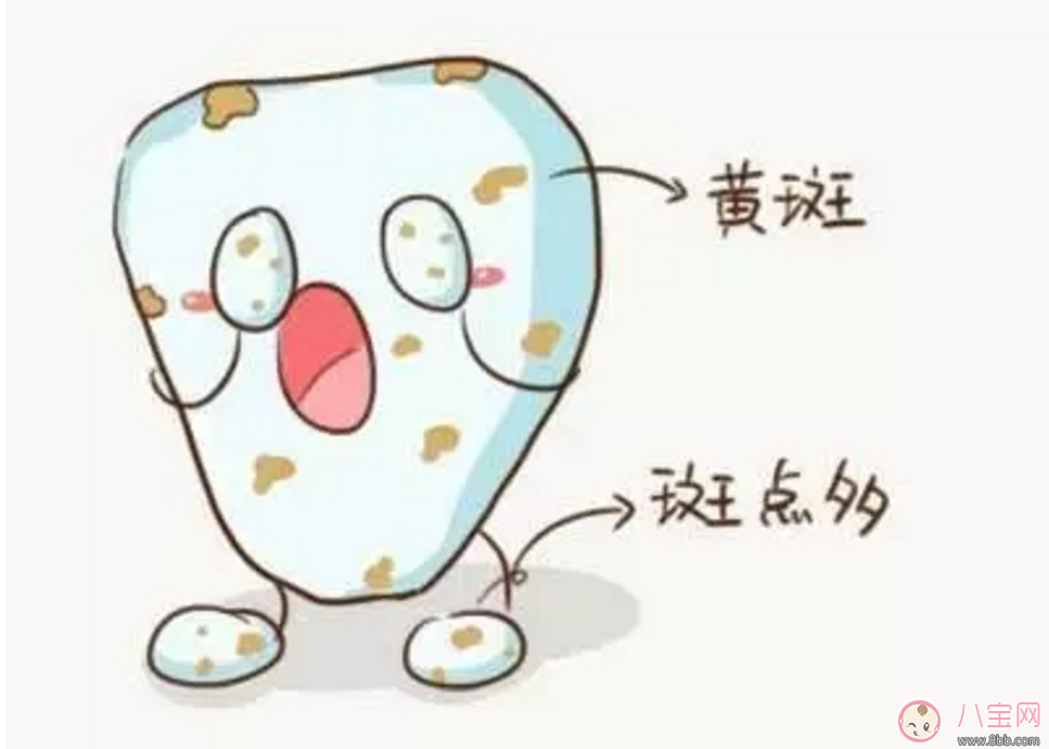 寶寶沒有齲齒 卻有黑牙是怎么回事？