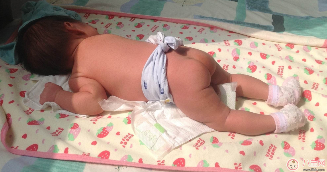 覺(jué)得孩子越曬越健康 不要把孩子曬傷了再去后悔