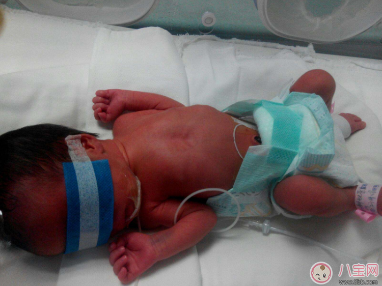 早產寶寶太小怎么照顧 各項注意到一樣是個健康寶寶