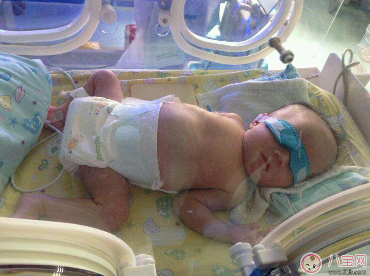 早產寶寶太小怎么照顧 各項注意到一樣是個健康寶寶