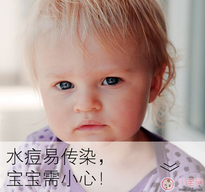 孩子長水痘這些東西千萬遠(yuǎn)離 孩子水痘好得快方法 孩子長水痘這些東西千萬遠(yuǎn)離 孩子水痘好得快方法