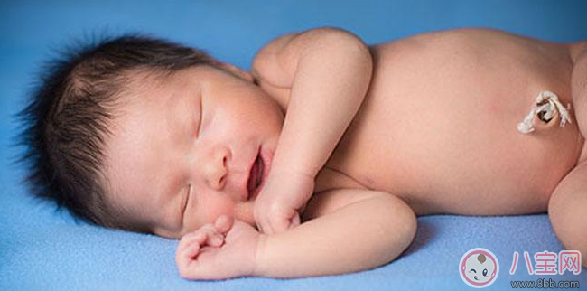 看到孩子肚臍這四種情況要當心 最好早點及時就醫(yī)