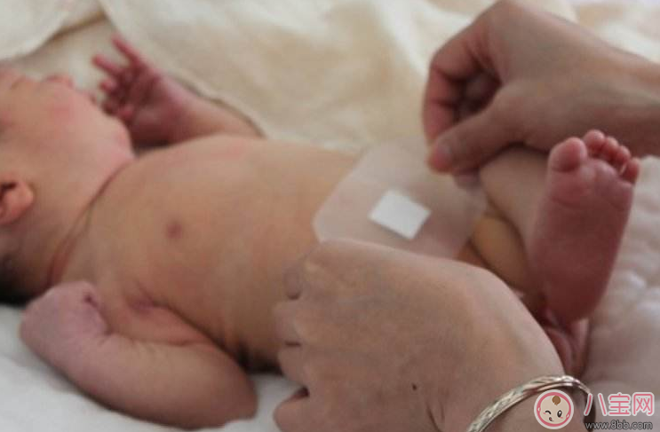 看到孩子肚臍這四種情況要當心 最好早點及時就醫(yī)