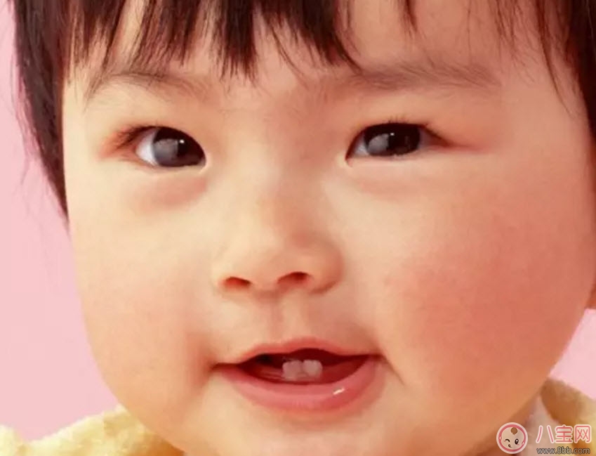 寶寶不長牙是什么原因 寶寶長牙的征兆有哪些