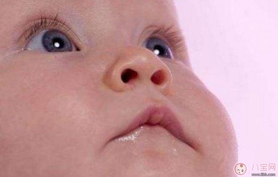 寶寶斜視手術(shù)風險大嗎 寶寶斜視一定要做手術(shù)嗎