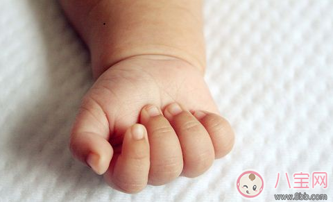 孩子手上長倒刺 寶媽應(yīng)該這么做 孩子手上長倒刺 寶媽應(yīng)該這么做