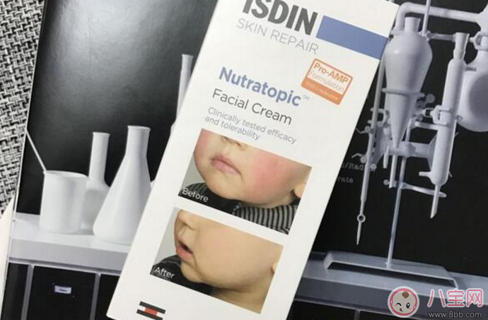 痱子和濕疹有什么區(qū)別 怎么預(yù)防痱子和濕疹