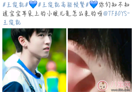 孩子耳朵上面有小孔是什么 耳朵的小孔是富貴孔嗎